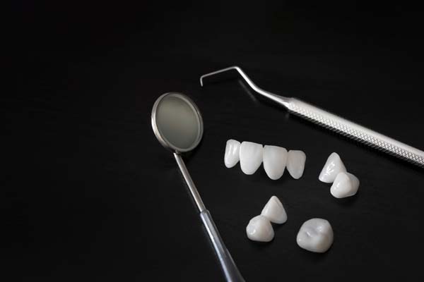 Caring For And Maintaining Your Dental Bridge