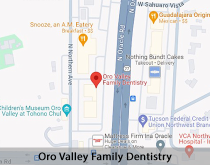 Map image for Options for Replacing Missing Teeth in Tucson, AZ