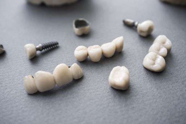 Types of Dental Implants from Oro Valley Family Dentistry in Tucson, AZ
